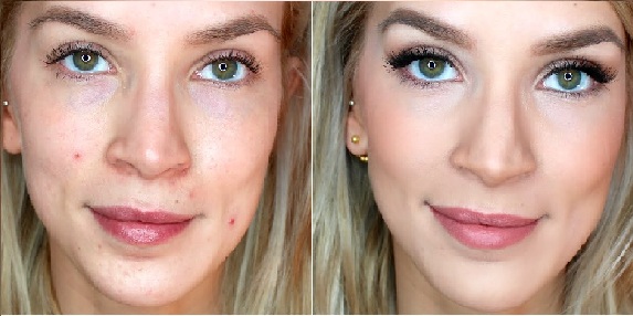 17 Effective Tips for Concealing Acne Scars